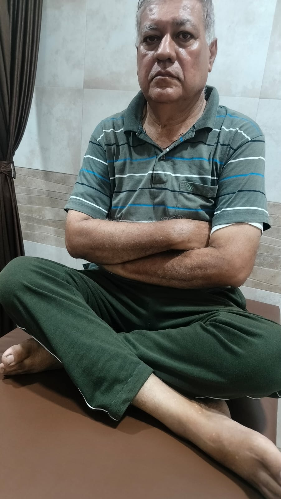 Post-Op TKR Result Vadodara