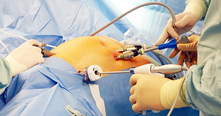 Gynaec & General Laparoscopic Surgery