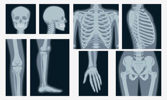 X-Ray